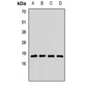 LifeSab™ RPL23A Rabbit pAb (50 µl)
