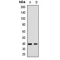 LifeSab™ SH3GL3 Rabbit pAb (50 µl)