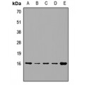 LifeSab™ VAMP4 Rabbit pAb (50 µl)