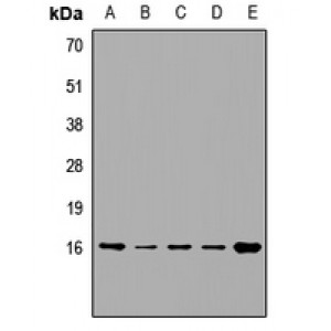 LifeSab™ VAMP4 Rabbit pAb (50 µl)