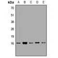 LifeSab™ EIF1AY Rabbit pAb (50 µl)