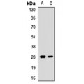 LifeSab™ EIF4E2 Rabbit pAb (50 µl)