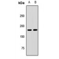 LifeSab™ PTPN23 Rabbit pAb (50 µl)