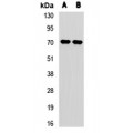 LifeSab™ CROT Rabbit pAb (50 µl)