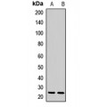LifeSab™ CBR4 Rabbit pAb (50 µl)