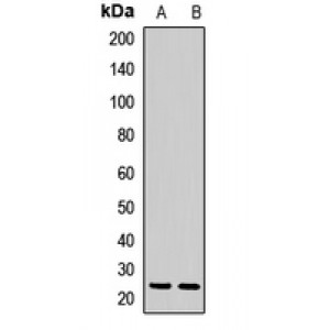 LifeSab™ CBR4 Rabbit pAb (50 µl)