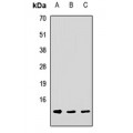 LifeSab™ DNAJC19 Rabbit pAb (50 µl)