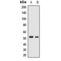 LifeSab™ RASSF6 Rabbit pAb (50 µl)