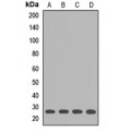 LifeSab™ GSTK1 Rabbit pAb (50 µl)