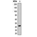 LifeSab™ SETD8 Rabbit pAb (50 µl)
