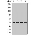 LifeSab™ BACE1 Rabbit pAb (50 µl)