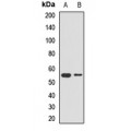 LifeSab™ PEPD Rabbit pAb (50 µl)