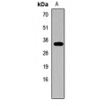 LifeSab™ GNRH1 Rabbit pAb (50 µl)