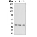 LifeSab™ Serpin A6 Rabbit pAb (50 µl)