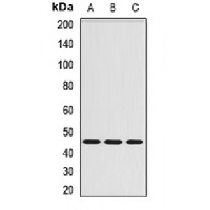 LifeSab™ Serpin A6 Rabbit pAb (50 µl)
