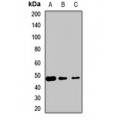 LifeSab™ eTF1 Rabbit pAb (50 µl)