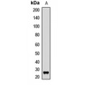 LifeSab™ THOC4 Rabbit pAb (50 µl)