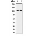 LifeSab™ PIWIL2 Rabbit pAb (50 µl)