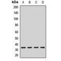 LifeSab™ AKTIP Rabbit pAb (50 µl)