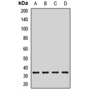 LifeSab™ AKTIP Rabbit pAb (50 µl)