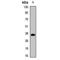 LifeSab™ CD231 Rabbit pAb (50 µl)