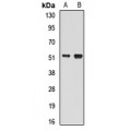 LifeSab™ BLMH Rabbit pAb (50 µl)