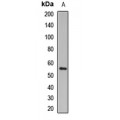 LifeSab™ CD200 Rabbit pAb (50 µl)