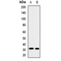 LifeSab™ GNMT Rabbit pAb (50 µl)