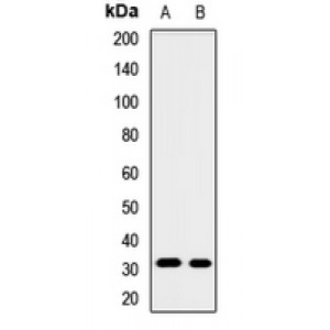 LifeSab™ GNMT Rabbit pAb (50 µl)