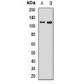 LifeSab™ GRP170 Rabbit pAb (50 µl)