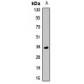 LifeSab™ LECT1 Rabbit pAb (50 µl)