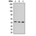 LifeSab™ PPAR alpha Rabbit pAb (50 µl)