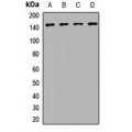 LifeSab™ BRIP1 Rabbit pAb (50 µl)