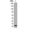 LifeSab™ SSX2 Rabbit pAb (50 µl)