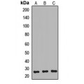 LifeSab™ NTMT1 Rabbit pAb (50 µl)