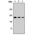 LifeSab™ ALS2CR6 Rabbit pAb (50 µl)
