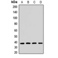 LifeSab™ NDUFAF5 Rabbit pAb (50 µl)