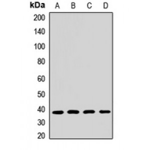 LifeSab™ NDUFAF5 Rabbit pAb (50 µl)
