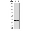 LifeSab™ FOXN2 Rabbit pAb (50 µl)