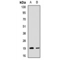 LifeSab™ SSAT2 Rabbit pAb (50 µl)