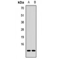 LifeSab™ p53 AIP1 Rabbit pAb (50 µl)