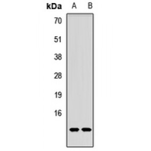 LifeSab™ p53 AIP1 Rabbit pAb (50 µl)