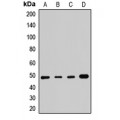 LifeSab™ SMYD3 Rabbit pAb (50 µl)