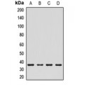 LifeSab™ CHMP4B Rabbit pAb (50 µl)