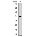 LifeSab™ PNLIP Rabbit pAb (50 µl)