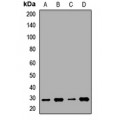 LifeSab™ CD242 Rabbit pAb (50 µl)