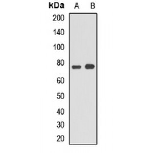 LifeSab™ ACSL5 Rabbit pAb (50 µl)