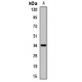 LifeSab™ IFNGR2 Rabbit pAb (50 µl)