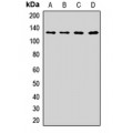 LifeSab™ Calpastatin Rabbit pAb (50 µl)