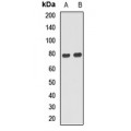 LifeSab™ ANKS1B Rabbit pAb (50 µl)